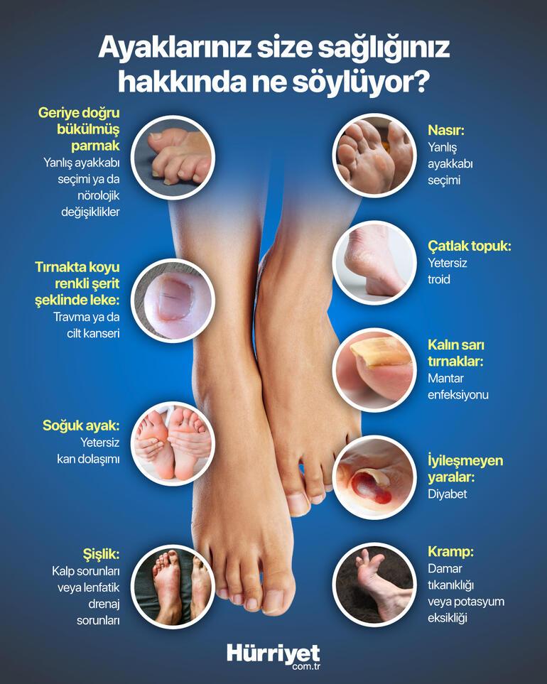Soğuk ayaklar, topuk çatlağı, kalın tırnaklar... Ayaklarımız sağlığımız hakkında bize ne söylüyor